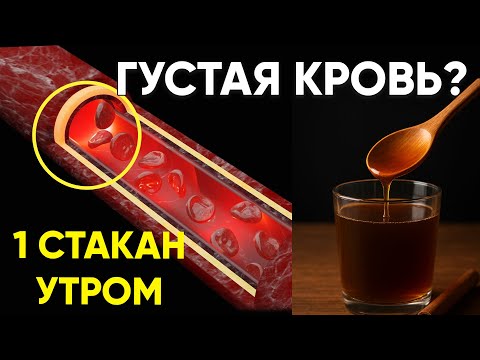 Видео: Боитесь тромбов? Этот утренний напиток и 3 ошибки, которые сгущают кровь, изменят вашу жизнь!