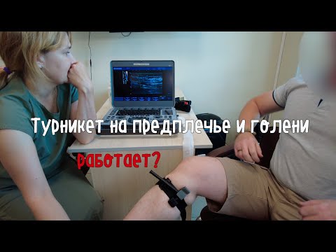 Видео: Наложение турникетов на разные отделы конечностей под УЗИ-контролем #FirstAidFire