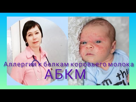 Видео: Аллергия к белкам коровьего молока– АБКМ.
