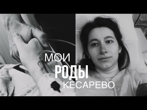 Видео: мои  первые роды | кесарево| ощущения и состояние после родов