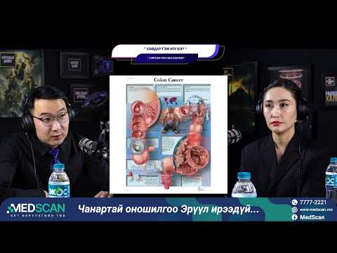Видео: Хавдар гэж юу вэ? - ХЭРХЭН 100 НАСЛАХ ВЭ?