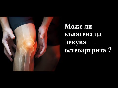 Видео: КОЛАГЕН за стави - помага ли при остеоартрит ?