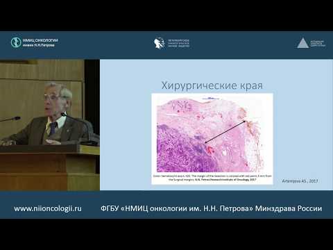 Видео: Факторы, влияющие на рецидив после органосохраняющего лечения