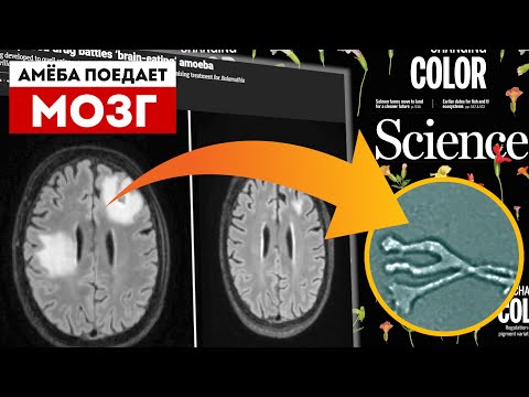 Видео: Амёба поедает мозг | Наука VS Паразитов | Balamuthia mandrillaris