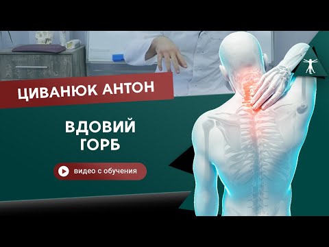 Видео: Правда о том, откуда появляется вдовий горб. Циванюк Антон
