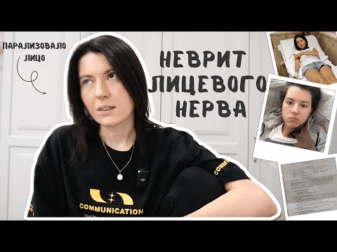 Видео: Неврит лицевого нерва. Как с этим жить? Моя история: лечение и реабилитация