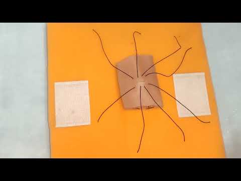 Видео: Симутомия — изучение закрытия перфораций кишечника #кишечныйанастомоз #перфорациикишечника