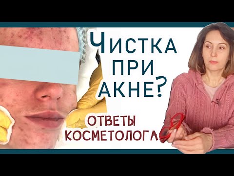 Видео: 146| Чистка лица - добро или зло? Кому нужна? При акне. Куда идти? отвечаю на ваши вопросы