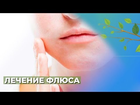 Видео: Флюс.Периостит челюсти☘️