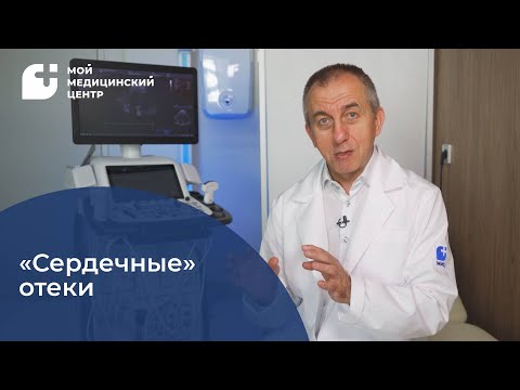 Видео: "Сердечные" отёки