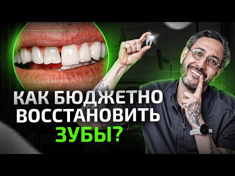Видео: 3 самых бюджетных способа восстановить зубы. Восстановление утраченных зубов