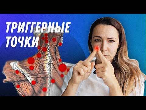 Видео: ТРИГГЕРНЫЕ ТОЧКИ | Остеопат Марина Просветина