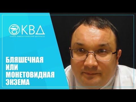 Видео: 1251  Бляшечная или монетовидная экзема