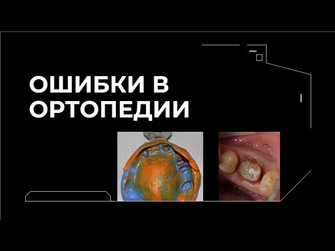 Видео: ОШИБКИ В ОРТОПЕДИИ ПРЕП РЕТРАКЦИЯ ОТТИСКИ