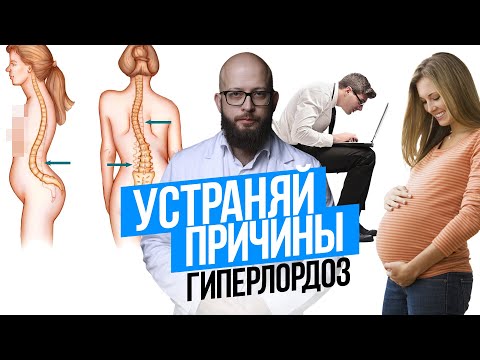 Видео: Гиперлордоз. Выпячивание живота. Причины и понимание проблем с телом.