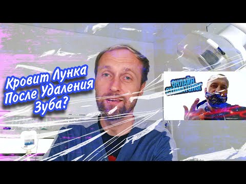 Видео: Кровит После Удаления Зуба. Что Можно Сделать Дома?