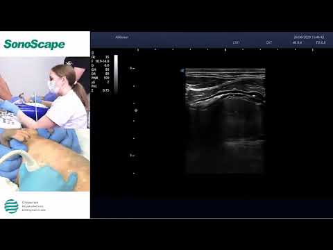 Видео: Мастер-класс Лапшиной М.В на аппарате SonoScape P9V. Тема: УЗИ ЖКТ у кошек