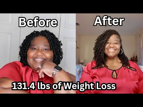 Видео: Как изменилось мое лицо после 2 лет и 8 месяцев использования Wegovy и ZepBound 💉 Реальная истори...