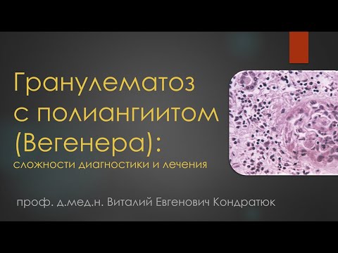Видео: Гранулематоз с полиангиитом (Вегенера): сложности диагностики и лечения