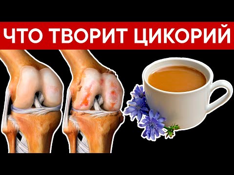 Видео: Пила ЧАШКУ ЦИКОРИЯ каждый день и избавилась 11 НЕДУГОВ! Приятно удивлена!