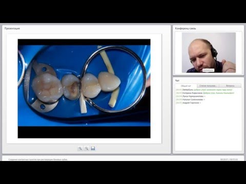 Видео: 2015 07 21 Создание контактных пунктов при реставрации боковых зубов