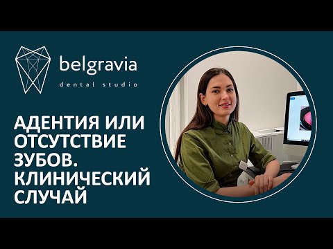 Видео: 🤷 Адентия или отсутствие зубов. Клинический случай