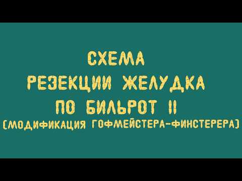 Видео: Схема резекции желудка по Бильрот II (модификация Гофмейстера-Финстерера)