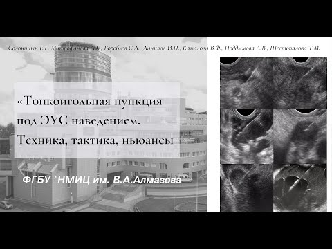 Видео: ЭУС ТАП. Техника, тактика, ньюансы