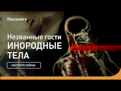 Видео: Незваные гости | Инородные тела | Discovery