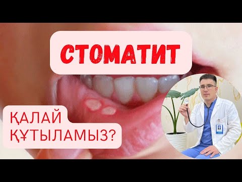 Видео: Стоматит қазақша/Афтозный стоматит// Ауыз ойылуы // ДОКТОР
