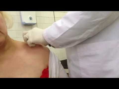 Видео: блокада в плечевой сустав