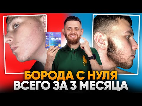 Видео: Вот что бывает, если использовать Ксиноксин по инструкции! Результат за 3 месяца!