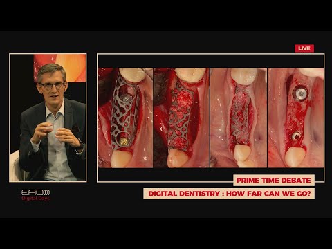 Видео: Цифровая стоматология Как далеко мы можем зайти Франк Ренуар Б Клинге С Мюхельманн С Вольфарт