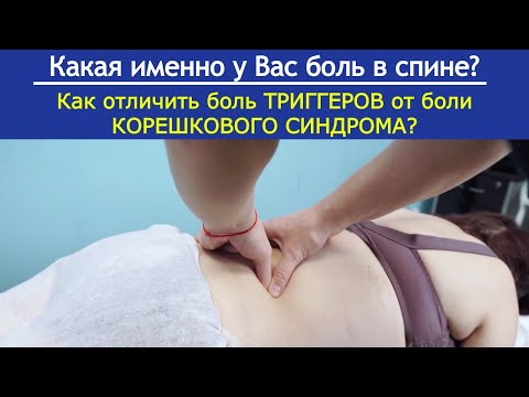 Видео: Как отличить БОЛЬ ТРИГГЕРОВ в спине от боли РАДИКУЛОПАТИИ?