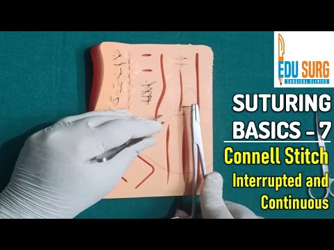 Видео: Кишечный анастомоз l Коннелл Стич l Станции навыков OSCE, часть 7 l Хирургические клиники