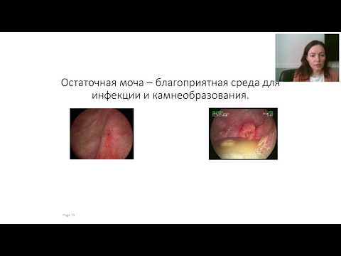 Видео: Час с урологом - 2. Этот страшный катетор.