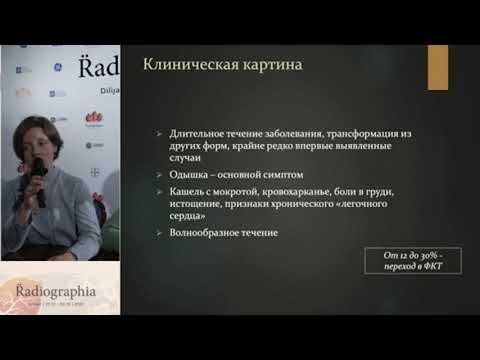 Видео: Диссеминированный туберкулёз лёгких  -  что должен знать рентгенолог?