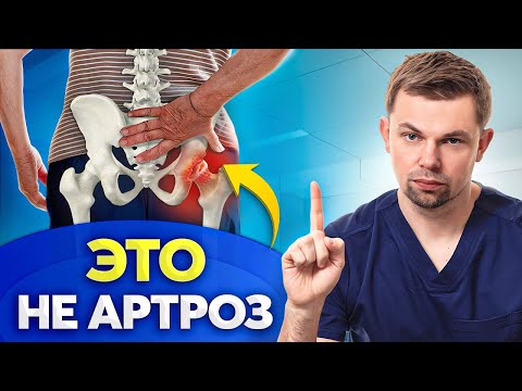 Видео: Трохантерит или артроз? Как не перепутать и как облегчить БОЛЬ?