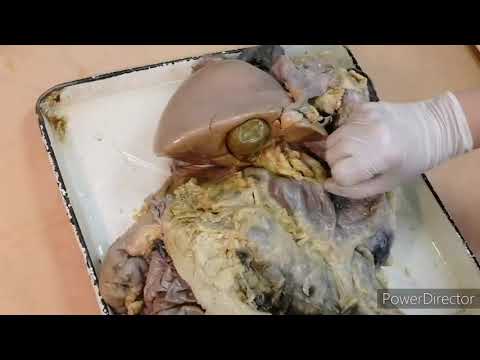 Видео: Топография брюшины