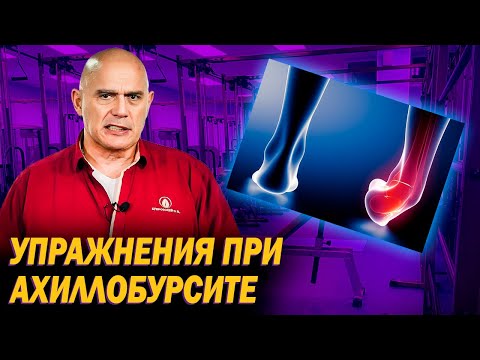 Видео: Причины появления ахиллобурсита. Как лечить воспаление сустава стопы упражнениями?