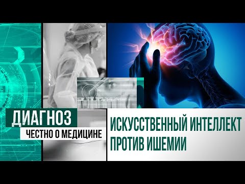 Видео: Машина вынесет вердикт: как казахстанский искусственный интеллект спасает при инсульте | Диагноз