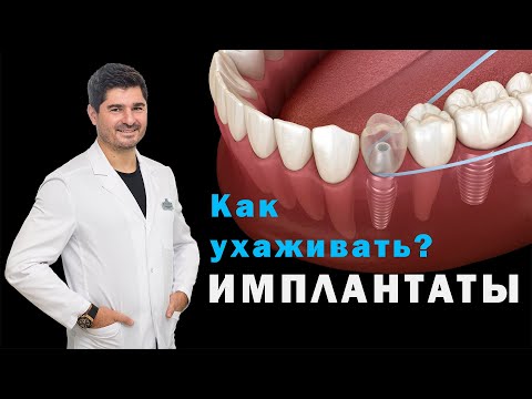 Видео: Как ухаживать за имплантами после установки? Ирригатор.