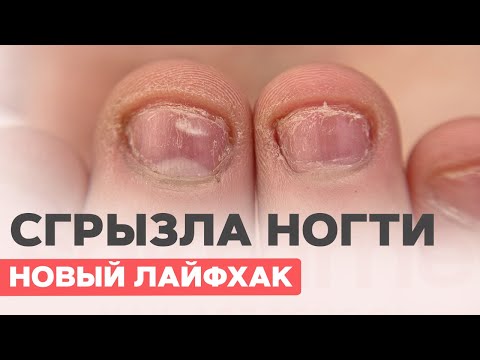 Видео: ПРЕОБРАЖЕНИЕ Обгрызенные ногти | Новый лайфхак маникюра
