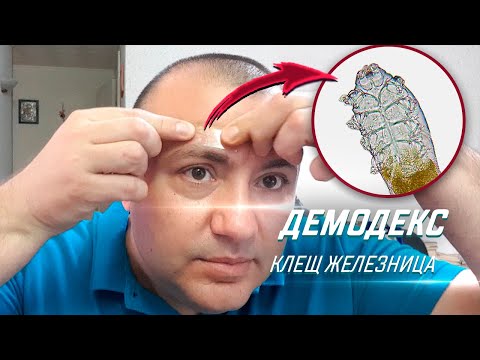 Видео: Мелкий паразит живет в коже каждого человека - Угревая Железница (Demodex)