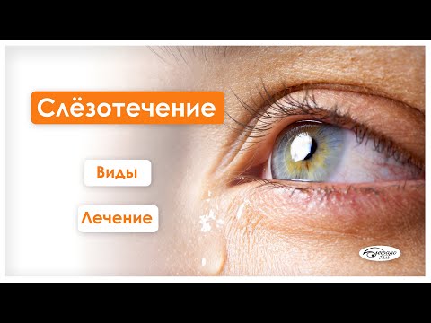 Видео: СЛЕЗОТЕЧЕНИЕ / у детей и взрослых / лечение