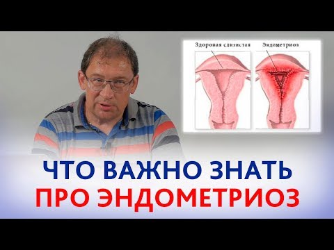 Видео: ЭНДОМЕТРИОЗ. Что ВАЖНО ЗНАТЬ про эндометриоз.