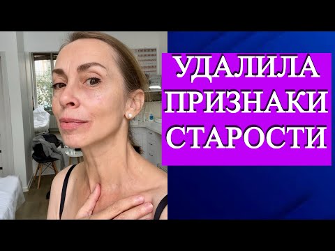 Видео: Признака старения, которые можно не заметить, но они забирают красоту