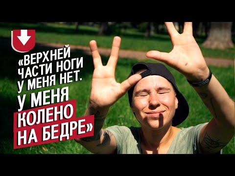 Видео: Я родилась с 3 пальцами и короткой ногой: Лина | Быть молодым