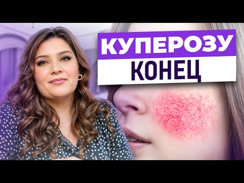 Видео: Самое ВАЖНОЕ о сосудах на лице! / Типы розацеа и способы ее лечения