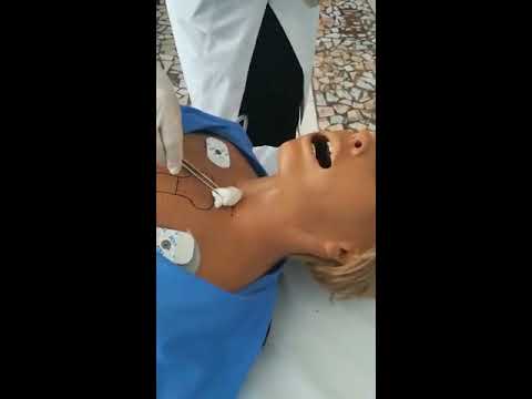 Видео: Коникотомия